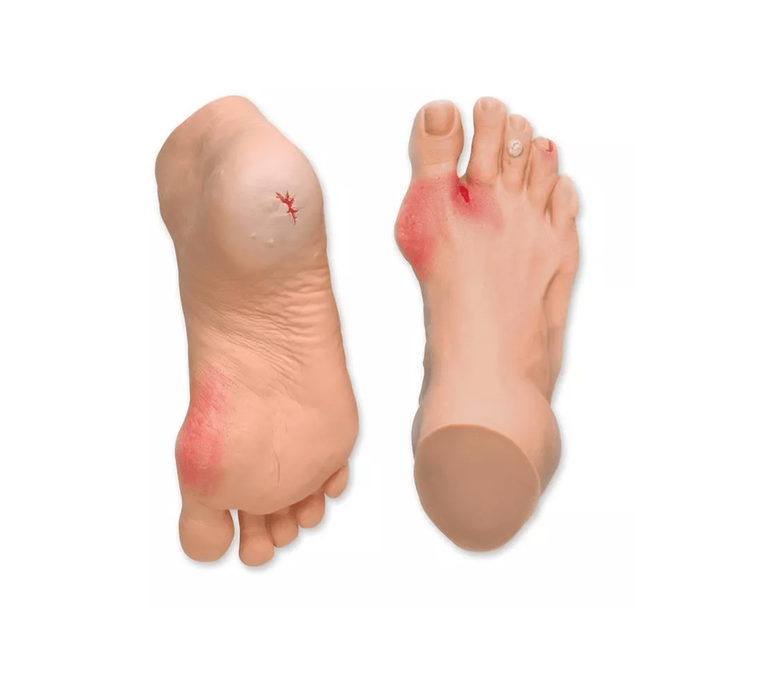 Häufige Fußprobleme - Erler - Zimmer